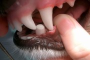 犬歯の歯折